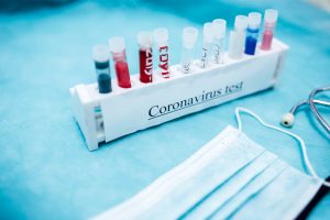 FDA публикует первые результаты проверки 12 тестов на антитела к COVID-19
